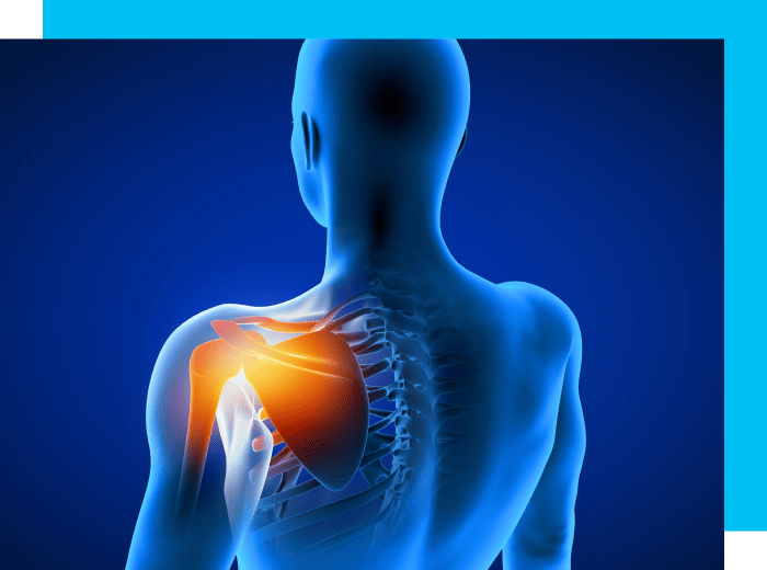 Image highlighting the internal anatomy of the shoulder joint.