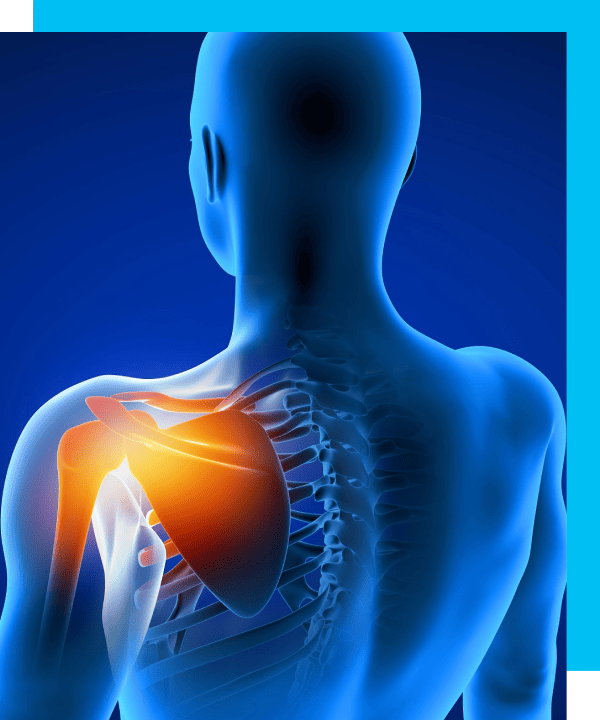 Image showing a man with shoulder pain.