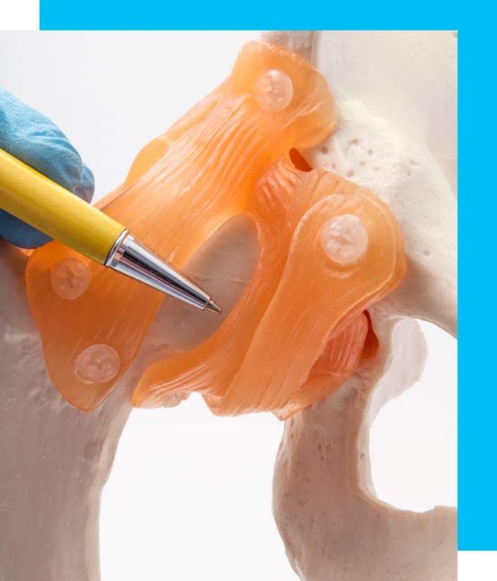 A model of a human hip.