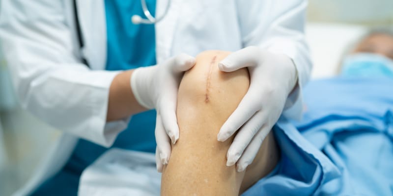 Close-up of an elderly person's knee after surgery.